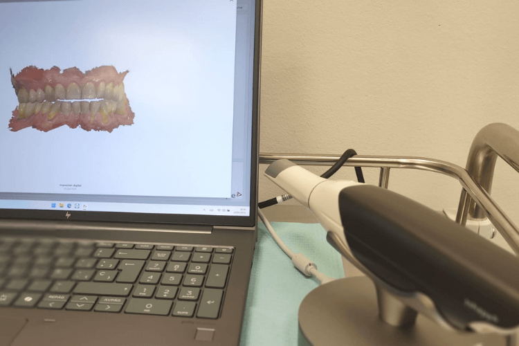 scanner intraoral